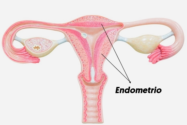 Clinica de Tratamiento de Endometrosis